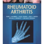 Rheumatoid Arthritis - Clinical Guide