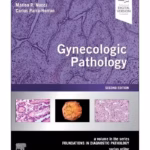 Gynecologic Pathology : A Volume in the Foundations in Diagnostic Pathology Series - 2nd Edition