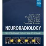 Neuroradiology: Spectrum and Evolution of Disease - 1st Edition Clinical Guide