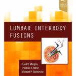 Lumbar Interbody Fusions - 1st Edition Clinical Guide
