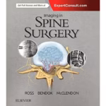 Imaging in Spine Surgery -1st Edition
