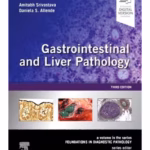 Gastrointestinal and Liver Pathology: A Volume in the Series: Foundations in Diagnostic Pathology - 3rd Edition