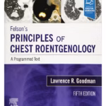 Felson's Principles of Chest Roentgenology - 5th Edition Clinical Guide