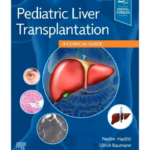 Pediatric Liver Transplantation - 1st Edition