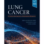 Lung Cancer - 1st Edition Medical Textbook