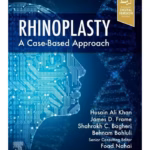 Rhinoplasty-1st Edition