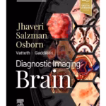 Diagnostic Imaging: Brain-4th Edition