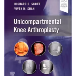 Unicompartmental Knee Arthroplasty - 1st Edition Medical Textbook