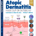 Atopic Dermatitis: Inside Out or Outside In - 1st Edition Medical Textbook
