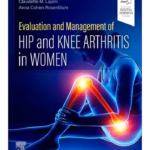 Evaluation and Management of Hip and Knee Arthritis in Women - 1st Edition Clinical Guide