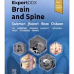 ExpertDDx: Brain and Spine - 3rd Edition