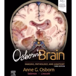 Osborn's Brain - 3rd Edition