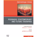 Psoriasis: Contemporary and Future Therapies - 1st Edition Clinical Guide