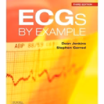 ECGs by Example-3rd Edition