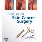 Practical Skin Cancer Surgery - 1st Edition Clinical Guide