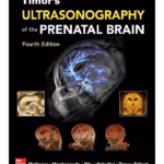 Ultrasonography of the Prenatal Brain - 4th Edition Medical Textbook