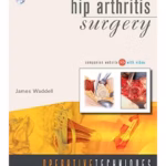 Operative Techniques: Hip Arthritis Surgery - 1st Edition Book, Website, and DVD Medical Textbook