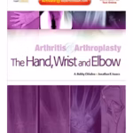 Arthritis and Arthroplasty: The Hand, Wrist and Elbow - 1st Edition Medical Textbook