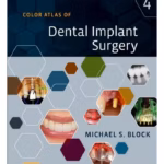 Color Atlas of Dental Implant Surgery - 4th Edition Clinical Guide