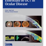 Essentials of OCT in Ocular Disease