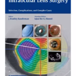 Intraocular Lens Surgery - 1st Edition Clinical Guide