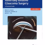 Minimally Invasive Glaucoma Surgery: A Practical Guide - 1st Edition Medical Textbook