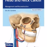 Head and Neck Cancer - 2nd Edition Medical Textbook