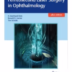 Femtosecond Laser Surgery in Ophthalmology - 1st Edition Clinical Guide