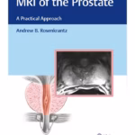 MRI of the Prostate: A Practical Approach - 1st Edition Medical Textbook