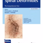 Spinal Deformities: Comprehensive Text - 2nd Edition Medical Textbook