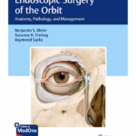 Endoscopic Surgery of the Orbit - 1st Edition Clinical Guide