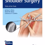 Shoulder Surgery Tricks of the Trade 1st Ed.
