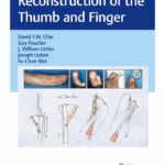 Reconstruction of the Thumb and Finger - 1st Edition Clinical Guide