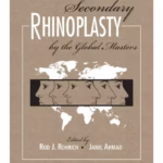 Secondary Rhinoplasty: By the Masters - Two Volume Set 1st Edition