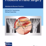 Problems in Hand Surgery: Solutions to Recover Function - 1st Edition Medical Textbook