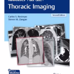RadCases Plus Q&A Thoracic Imaging: 2/e