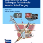Essential Step-by-Step Techniques for Minimally Invasive Spinal Surgery - 1st Edition Medical Textbook
