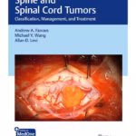 Spine and Spinal Cord Tumors: Classification, Management, and Treatment - 1st Edition Clinical Guide
