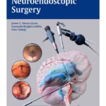 Neuroendoscopic Surgery - 1st Edition Clinical Guide