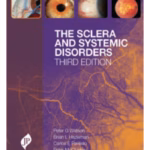 The Sclera And Systemic Disorders