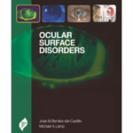 Ocular Surface Disorders
