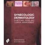 Gynecologic Dermatology Symptoms, Signs And Clinical Management