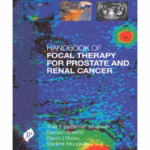 Handbook of Focal Therapy for Prostate and Renal Cancer - Medical Textbook