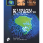 Eye Diseases In Hot Climates