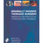 Minimally Invasive Thoracic Surgery Principles And Practice Of Thoracoscopic Technique