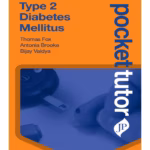 Type 2 Diabetes Mellitus: Pocket Tutor - Clinical Guide
