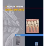 Specialty Imaging: Dental Implants