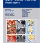 Atlas of Acoustic Neurinoma Microsurgery