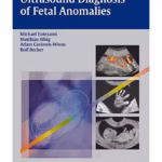 Ultrasound Diagnosis of Fetal Anomalies - Clinical Guide