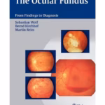 The Ocular Fundus